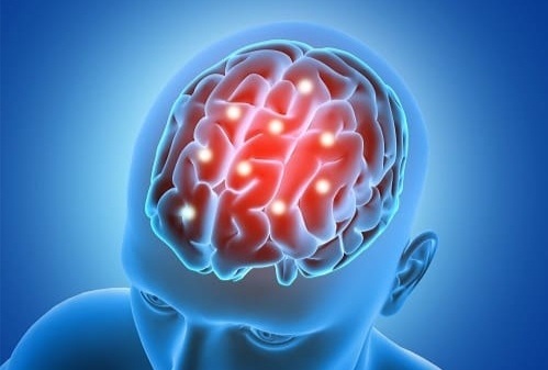 реабілітація після інсульту в Одесі